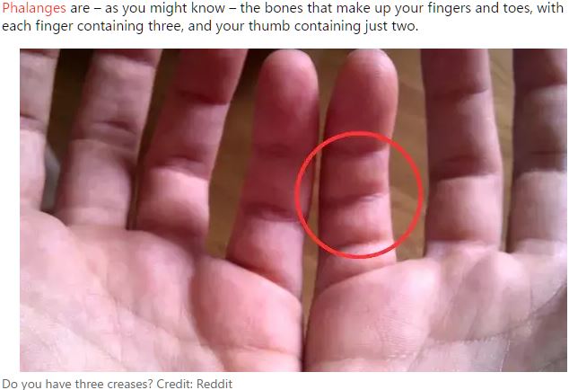 小指に「余分な関節」が存在する人がいる? 発生確率1%以下の超レアケースの画像2