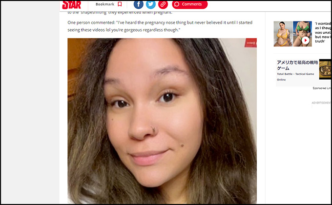 妊娠した女性が「シュレック化」!? 出産前後の激変ぶりにネット激震、別人説も唱えられるの画像3