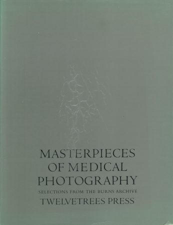奇形や奇病を記録した危ない医学・医療写真の数々! 驚異の陳列室「書肆ゲンシシャ」が所蔵する奇妙な本の画像6